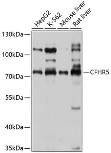 Antibodie to-CFHR5 