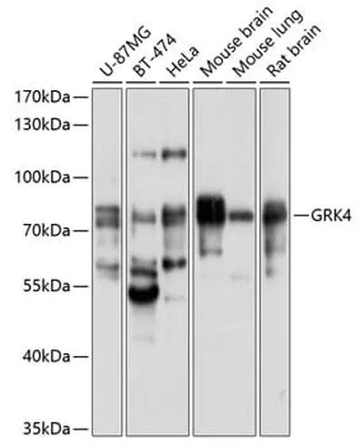 Antibodie to-GRK4 