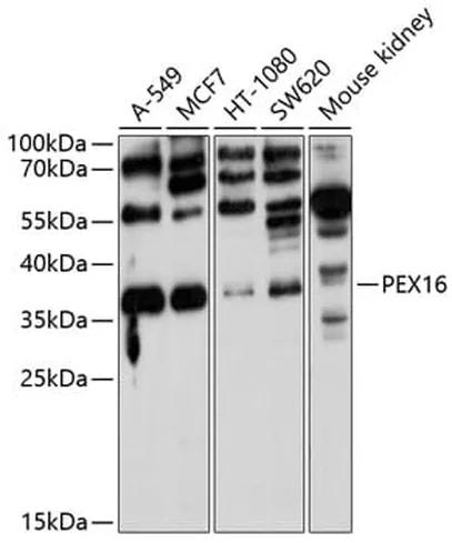 Antibodie to-PEX16 