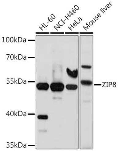 Antibodie to-SLC39A8 