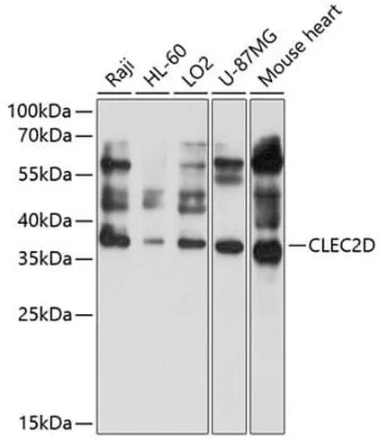 Antibodie to-CLEC2D 