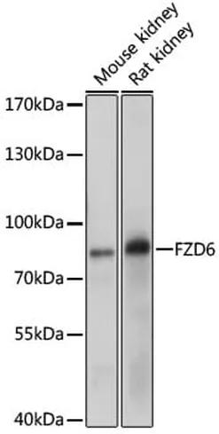 Antibodie to-FZD6 