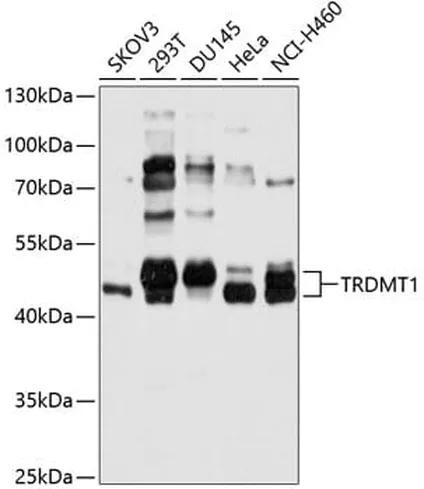 Antibodie to-TRDMT1 