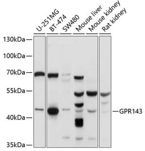 Antibodie to-GPR143 