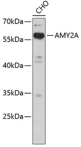 Antibodie to-ANXA7 