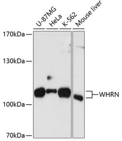 Antibodie to-WHRN 
