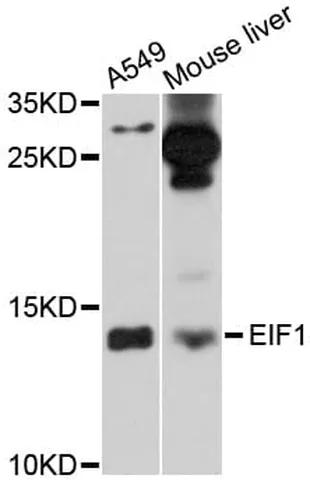 Antibodie to-EIF1 