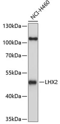 Antibodie to-LHX2 