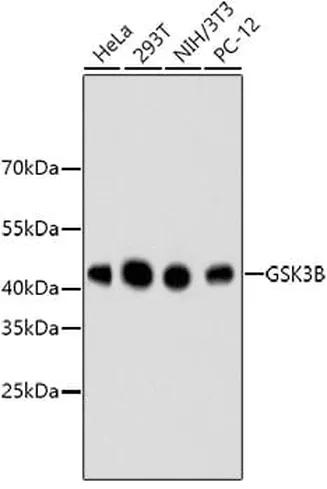 Antibodie to-GSK3B  [Assigned #A10877]
