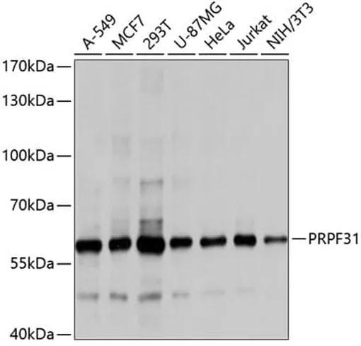 Antibodie to-PRPF31 