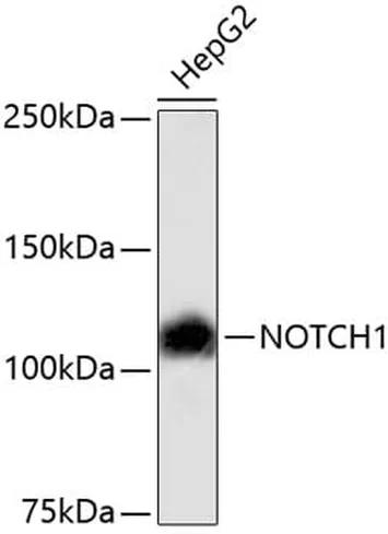 Antibodie to-NOTCH1  [Assigned #A11056]