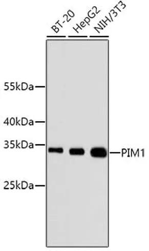 Antibodie to-PIM1  [Assigned #A11080]