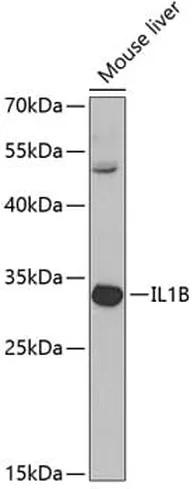 Antibodie to-IL1B 