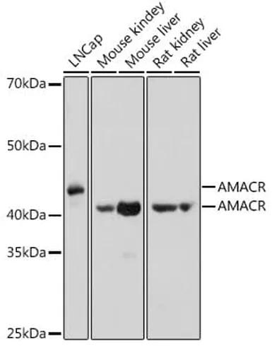 Antibodie to-AMACR 