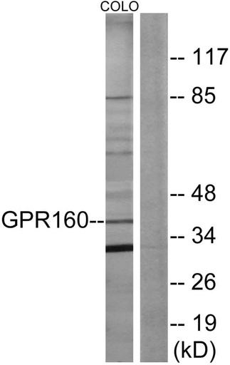Antibodie to-GPR160 