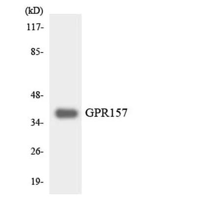 Antibodie to-GPR157 