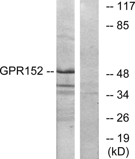 Antibodie to-GPR152 