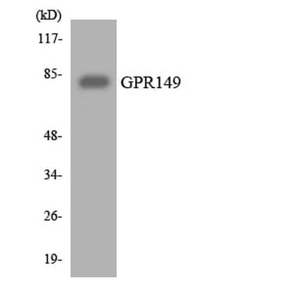 Antibodie to-GPR149 