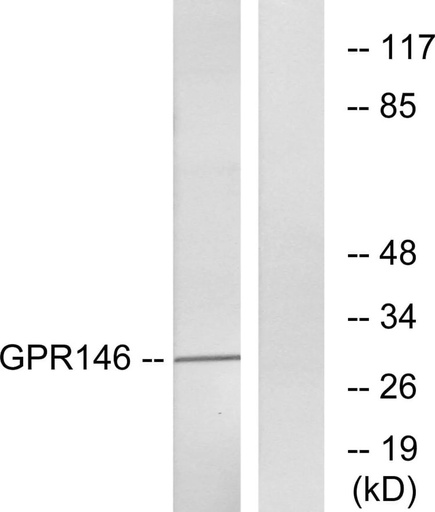 Antibodie to-GPR146 