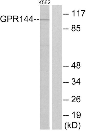 Antibodie to-GPR144 