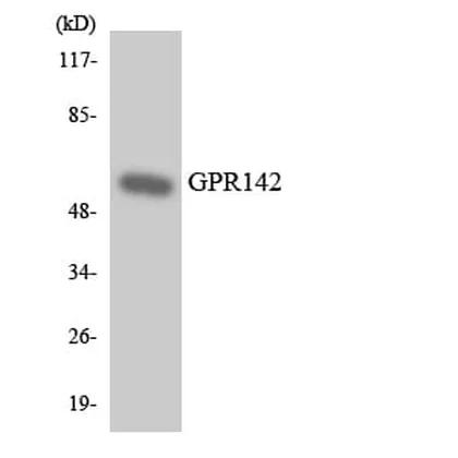 Antibodie to-GPR142 