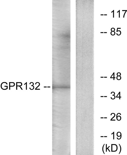 Antibodie to-GPR132 
