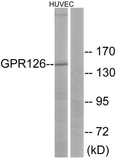 Antibodie to-GPR126  - Identical to Abcam (ab75356)