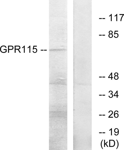 Antibodie to-GPR115 