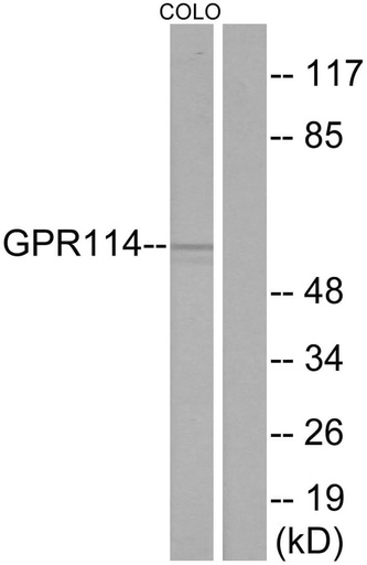 Antibodie to-GPR114 