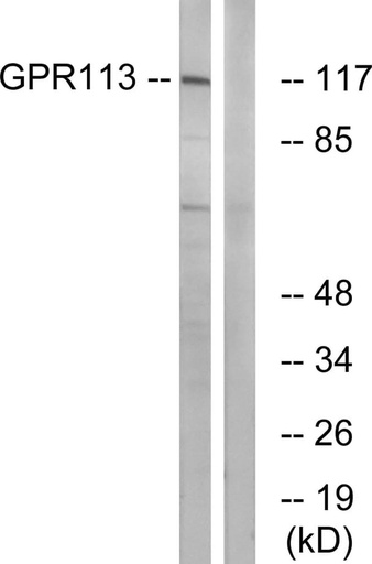 Antibodie to-GPR113 
