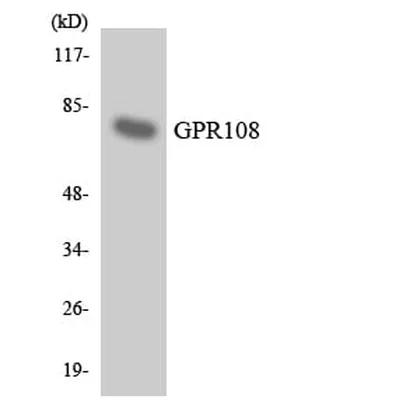 Antibodie to-GPR108 