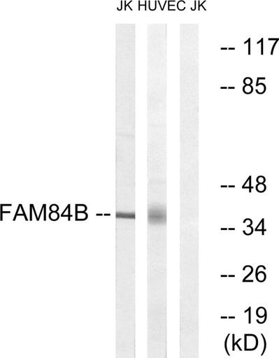 Antibodie to-FAM84B 