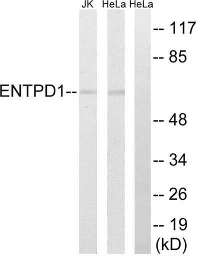 Antibodie to-ENTPD1 