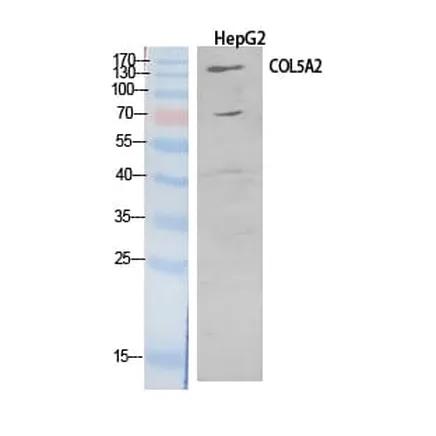 Antibodie to-COL5A2 