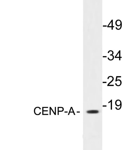 Antibodie to-CENP-A 