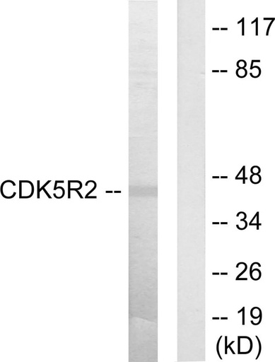 Antibodie to-CDK5R2 