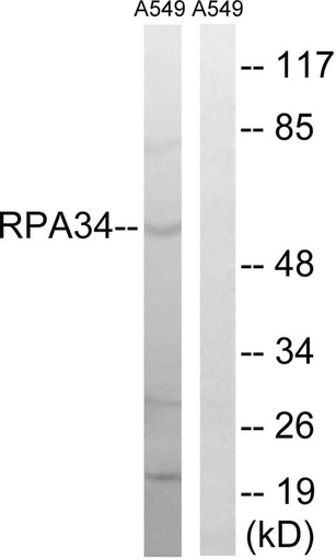 Antibodie to-CD3EAP 