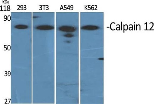 Antibodie to-CAPN12 