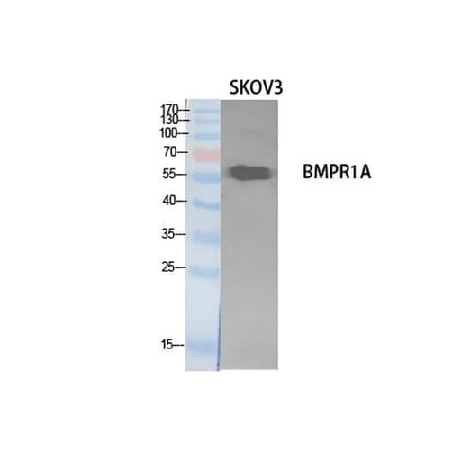 Antibodie to-BMPR1A 