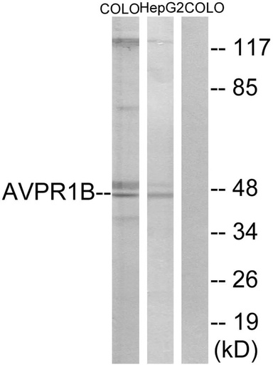 Antibodie to-AVPR1B 