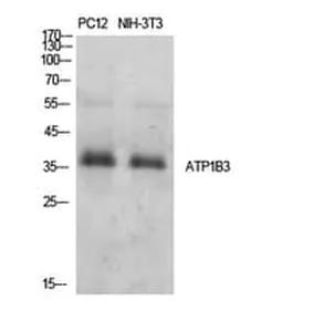 Antibodie to-ATP1B3 