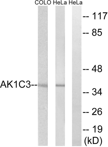 Antibodie to-AKR1C3 