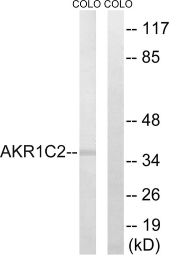 Antibodie to-AKR1C2 