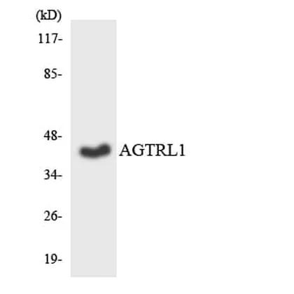 Antibodie to-AGTRL1 