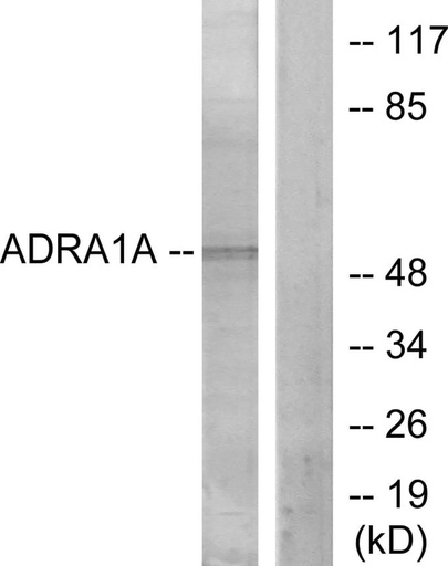 Antibodie to-ADRA1A 