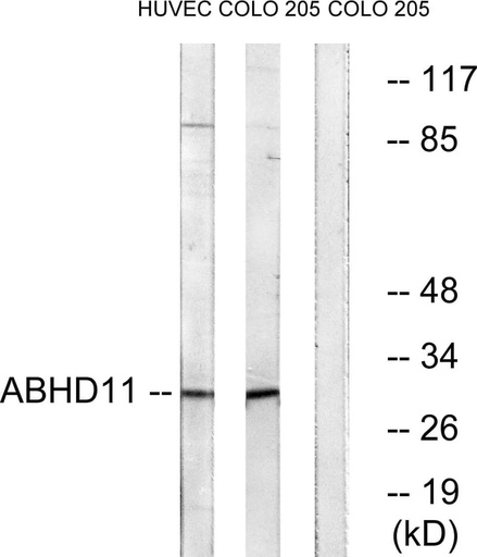Antibodie to-ABHD11 