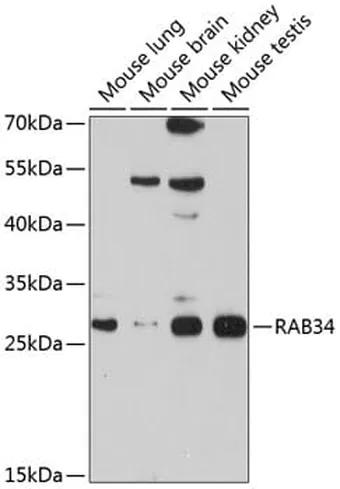 Antibodie to-RAB34 