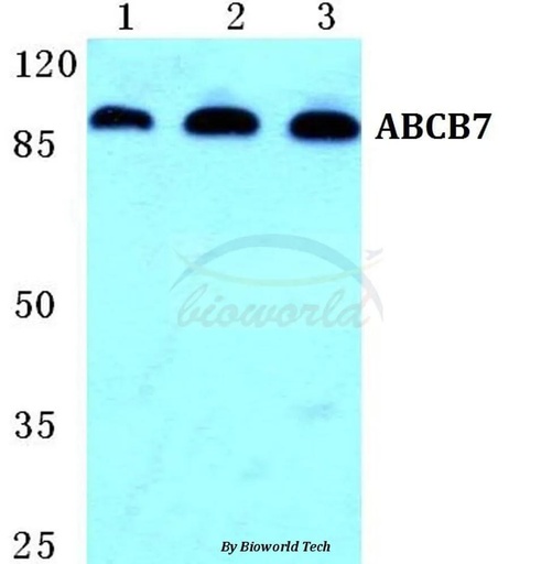 Antibodie to-ABCB7 