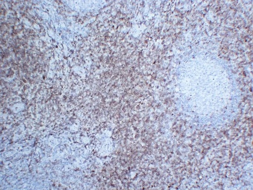Antibodie to-CD7  [ABT-CD7]