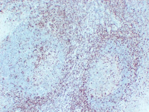 Antibodie to-CD5  [ABT-CD5]